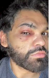 Psicólogo é agredido por homofobia em boate de Cuiabá